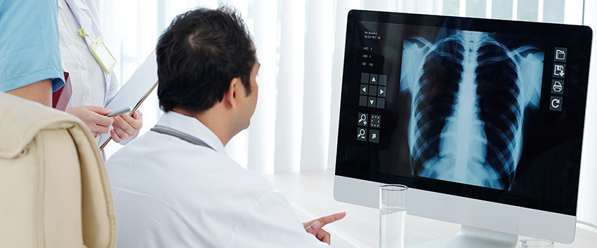 Lung Specialist in Siliguri